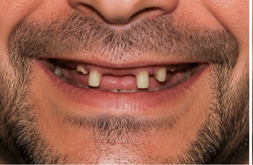 Patient before treatment